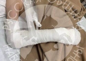 В Нижнекамске школьник сломал руку девочке