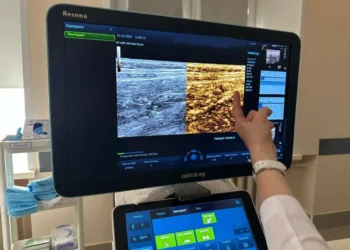 аппарат узи