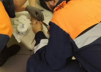 В Казани спасатели помогли снять кольцо с пальца ребенка