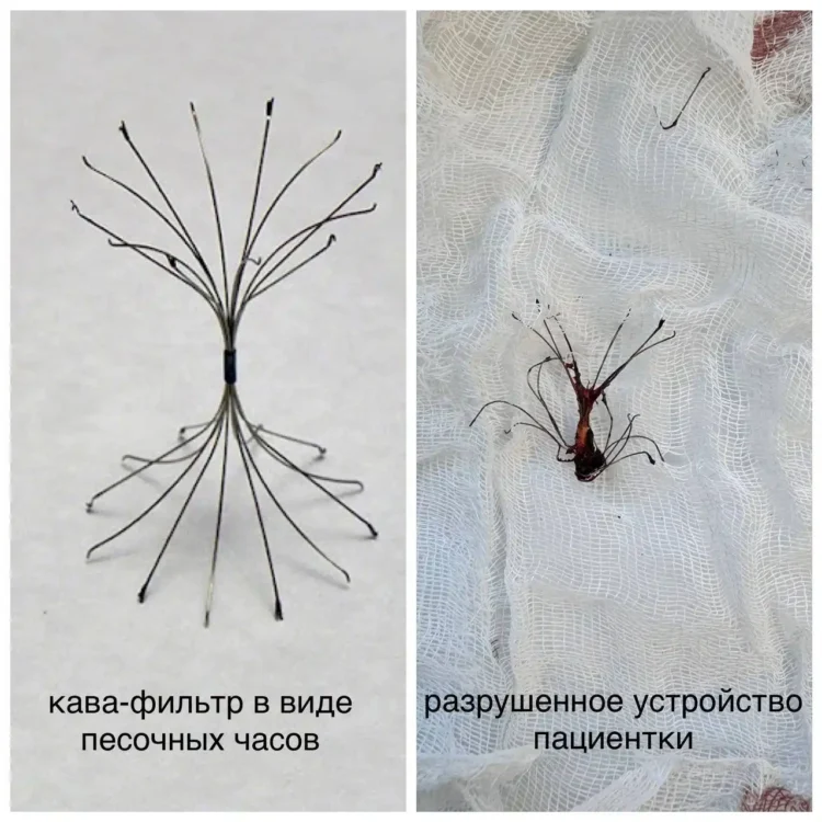 Фото: БСМП Челнов