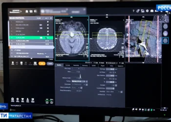 Татарстанцам рассказали, как избежать инсульта