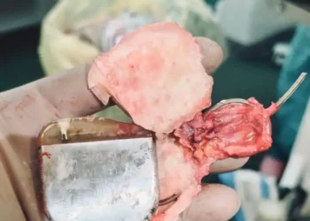 В БСМП им.Акчурина провели операцию по замене кардиостимулятора, проработавшего 32 года