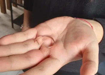 В Альметьевске спасатели помогли снять кольцо с пальца девушки