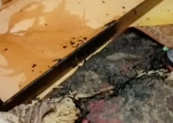 В Казани пенсионер пострадал при пожаре