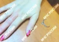 В Казани спасатели сняли кольцо с опухшего пальца женщины