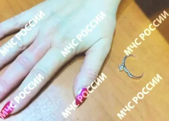 В Казани спасатели сняли кольцо с опухшего пальца женщины